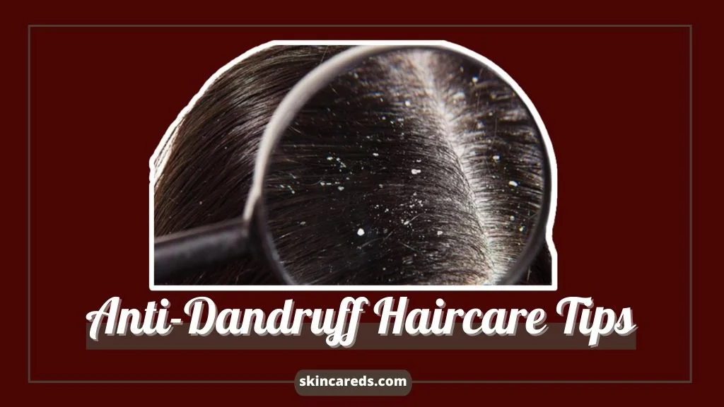 10 Best Natural Home Remedies to Get Rid of Dandruff and Hair Fall Permanently