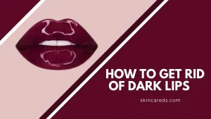 How to Get Rid of Dark Lips Worried About the Darkening of Lips