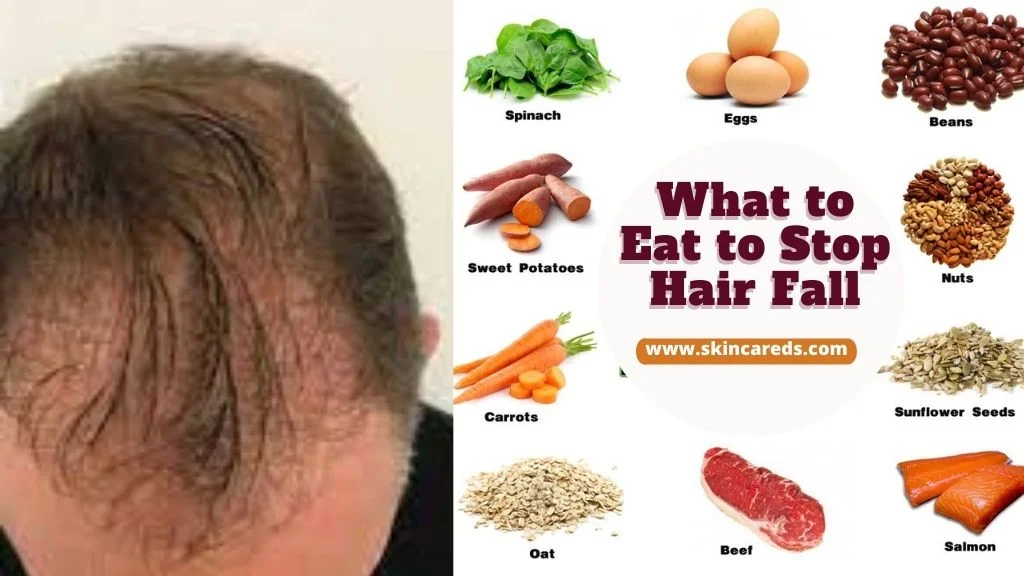 What to Eat to Stop Hair Fall Immediately | 17 Best Foods to Prevent Hair  Loss 2023 - SkinCareDS